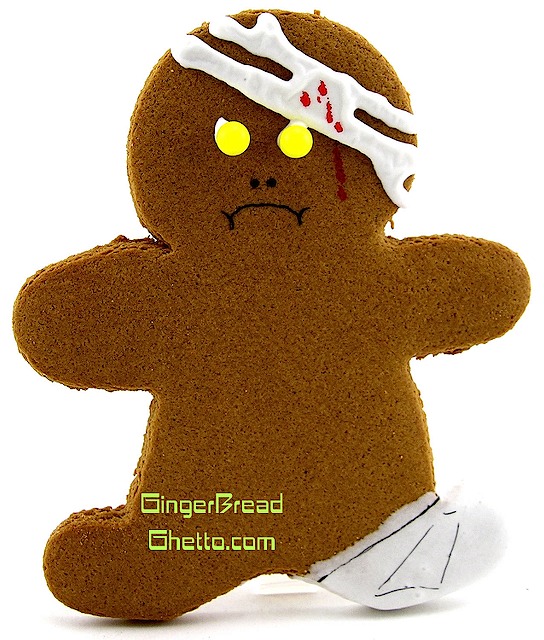 gingerbread-leg-cast